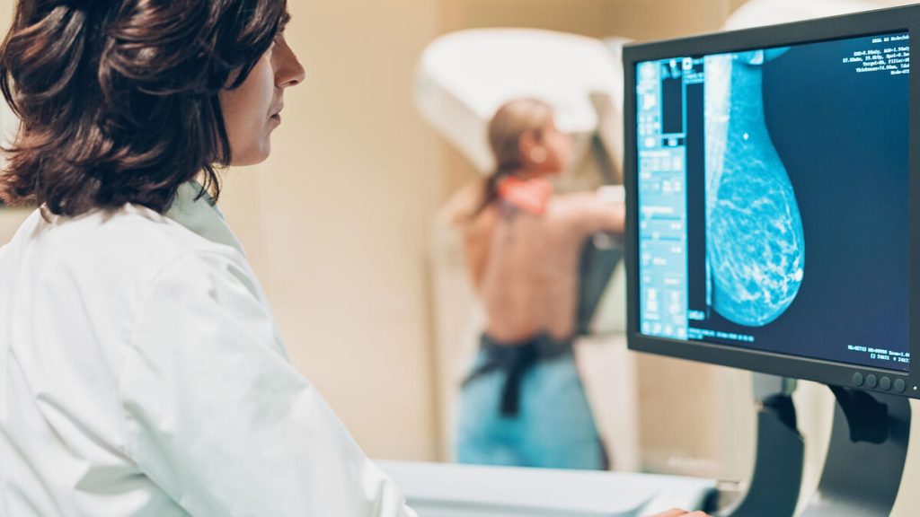 Cancer du sein : les députés approuvent une loi visant à améliorer la prise en charge des soins