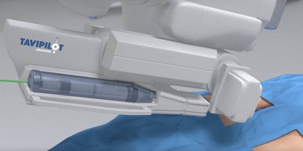 Spécialiste de la robotique chirurgicale, la medtech basée à Nice vient de soumettre son logiciel de guidage opératoire à la FDA .